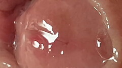 Precum collecting in my foreskin for you to see close up Thumb