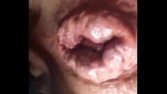 FuckMachine in my already Overfucked puffy asshole Thumb